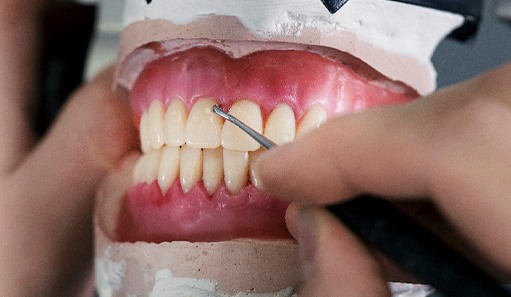 Technician crafting dentures in Oshkosh dental lab
