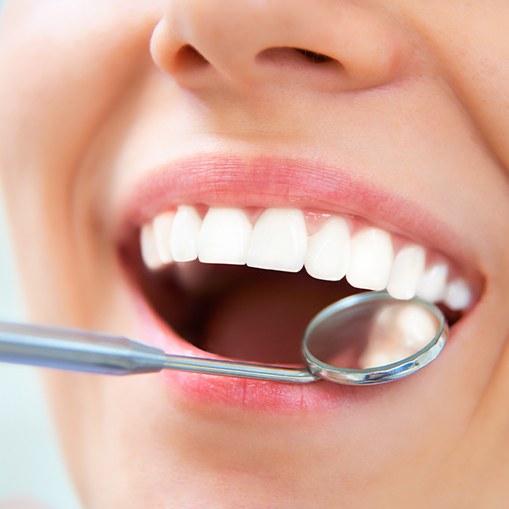 Dentist checking patient's smile after tooth colored filling treatment