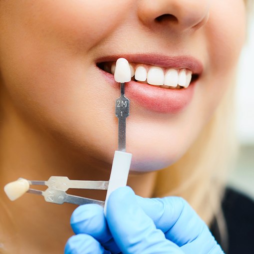 Patient's smile compared with porcelain veneer shade options