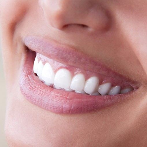 Patient's smile after scaling and root planing gum disease treatment
