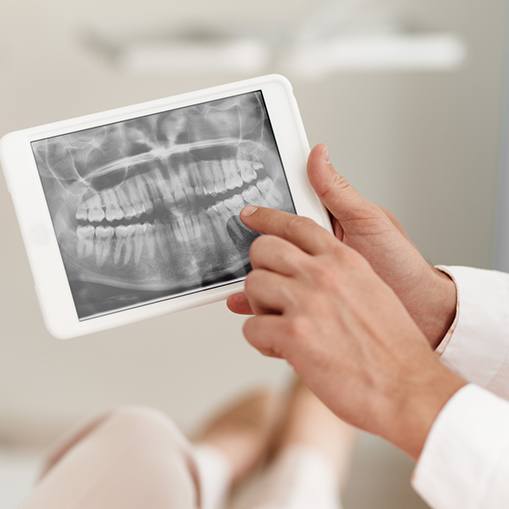 Digital dental x-rays on tablet computer