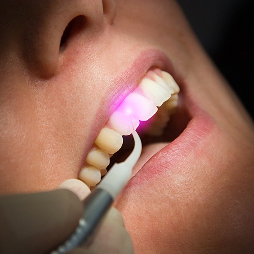 Patient receiving soft tissue laser dentistry treatment