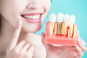 a woman smiling and holding a model of dental implants in Oshkosh