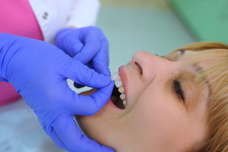 female patient receiving custom veneers